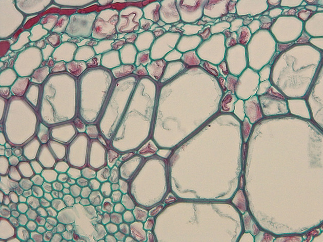Fern Stem Slides - Fernstem 02 400X